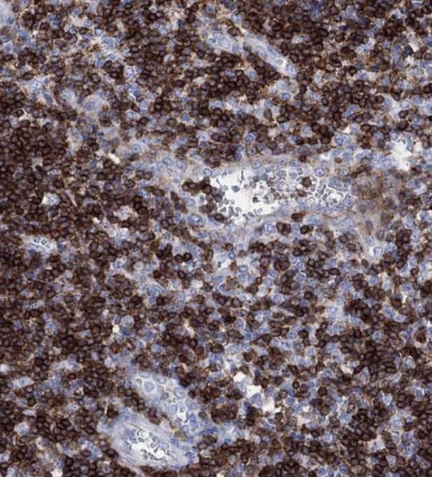  Staining of human tonsil shows strong membranous positivity in non-germinal center cells.