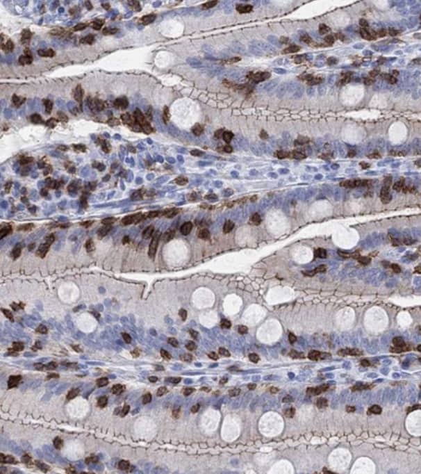 Staining of human small intestinal shows strong membranous positivity in lymphoid cells and glandular cells,