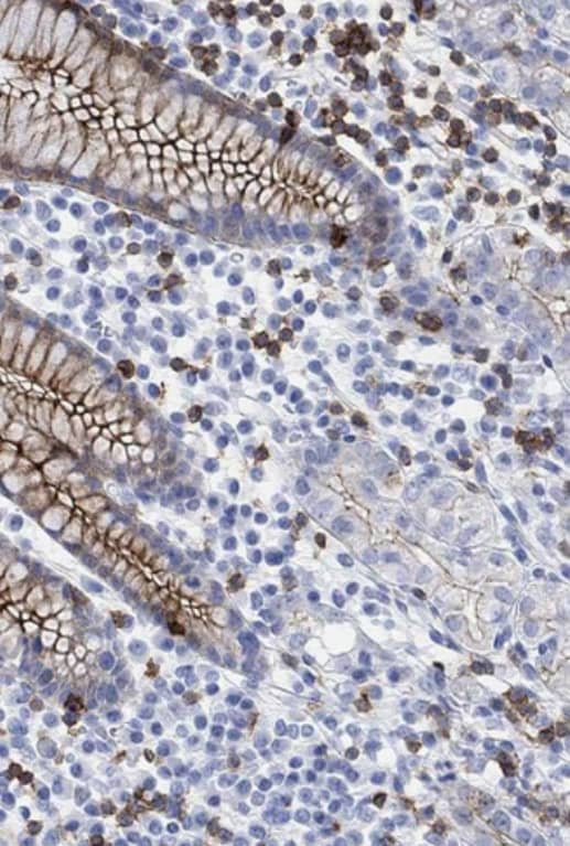 Staining of human stomach shows strong membranous positivity in glandular cells and lymphoid cells