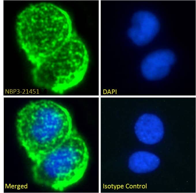 Immunocytochemistry/ Immunofluorescence: Rabbit MUC1 mAb (Mc5) - Chimeric [NBP3-21451] - Immunofluorescence analysis of paraformaldehyde fixed MCF7 cells permeabilized with 0.15% Triton and stained with the chimeric mouse IgG1 version of Mc5 at 10 ug/ml for1h followed by Alexa Fluor® 488 secondary antibody (2 ug/ml), showing membrane staining. The nuclear stain is DAPI (blue). Panels show from left-right, top-bottom DAPI, merged channels and an isotype control. The isotype control was stained with an anti-unknown specificity antibody followed by Alexa Fluor® 488 secondary antibody.
