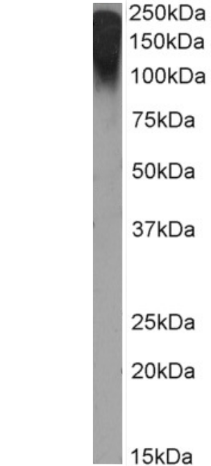 Western Blot: Rabbit MUC1 mAb (Mc5) - Chimeric [NBP3-21451] - MCF7 cell lysate (35µg protein in RIPA buffer) was resolved on a 10% SDS PAGE gel and blots probed with the chimeric rabbit IgG version of Mc5 at 2 µg/ml before detection using an anti-rabbit secondary antibody. A primary incubation of 1h was used and protein was detected by chemiluminescence. The expected running size for unmodified breast epithelial mucin is 122.1kDa, but this protein is heavily glycosylated and lipidated at several positions leading to the observed running size.