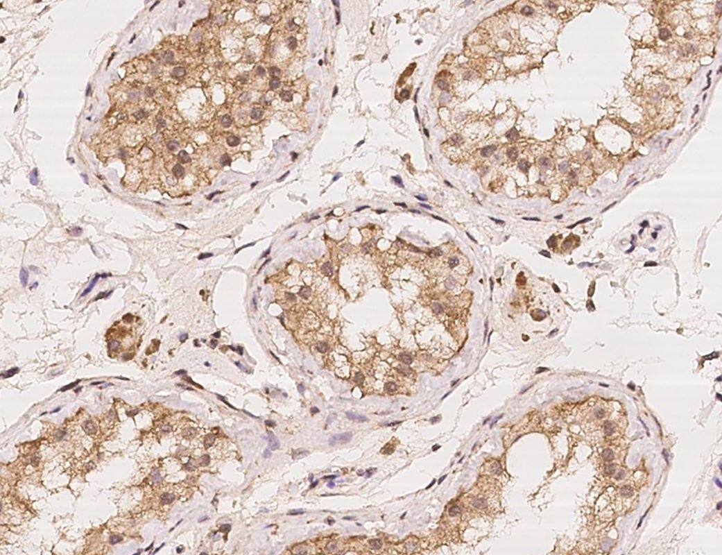 IHC-P-NBP3-21482-LIAT1 Antibody- Staining of human C17orf97 in human testis with rabbit polyclonal antibody at 1:100 dilution, formalin-fixed paraffin embedded sections.