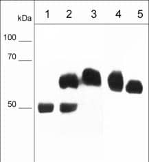 Western Blot: Mouse FXYD5/Dysadherin mAb (M029) [NBP3-23349] - Analysis of FXYD5/Dysadherin protein expression. Immunoprecipitates using FXYD5/Dysadherin Antibody (M031) (Catalog # NBP3-23350) only (lane 1) or FXYD5/Dysadherin Antibody (M031) with A431 lysate (lane 2) or A431 input only (lane 3). Human cell lysates MDA-MB-231 (lane 4) or MeWo (lane 5). The blot was probed with Mouse FXYD5/Dysadherin mAb (M029) at 1:1000.