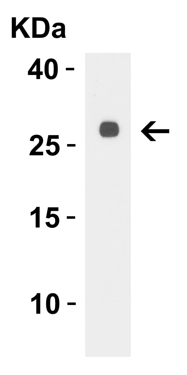 Western Blot: LpxT Antibody - BSA Free [NBP3-23512] - WB Validation of LpxT in E. coli. Loading: 15 ug of lysate. Antibodies: LpxT NBP3-23512, 0.5 ug/mL, 1 h incubation at RT in 5% NFDM/TBST. Secondary: Goat Anti-Rabbit IgG HRP conjugate at 1:10000 dilution.