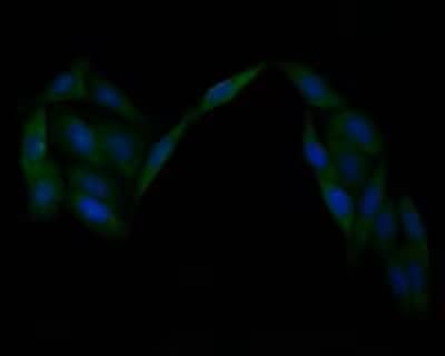  ICC staining of Integrin alpha V in SiHa cells (green). Formalin fixed cells were permeabilized with 0.1% Triton X-100 in TBS for 10 minutes at room temperature and blocked with 1% Blocker BSA for 15 minutes at room temperature.