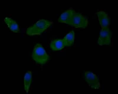 ICC staining of Integrin alpha V in A549 cells (green). Formalin fixed cells were permeabilized with 0.1% Triton X-100 in TBS for 10 minutes at room temperature and blocked with 1% Blocker BSA for 15 minutes at room temperature.