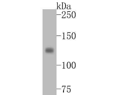 Western blot analysis of Integrin alpha V on A549 cell lysates. Proteins were transferred to a PVDF membrane and blocked with 5% BSA in PBS for 1 hour at room temperature. The primary antibody (1/500) was used in 5% BSA at room temperature for 2 hours.