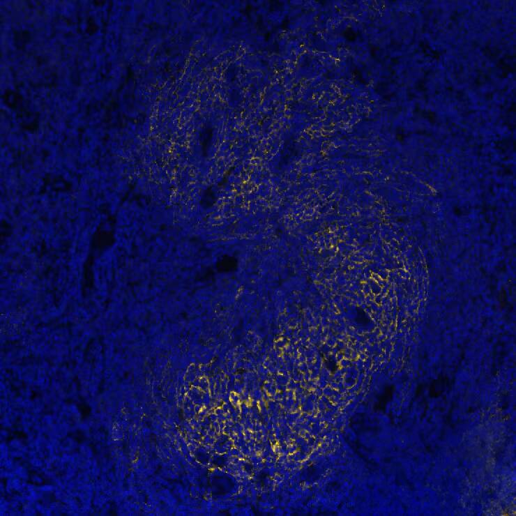 CD21 was detected in immersion fixed paraffin-embedded sections of human Hodgkin's Lymphoma using Mouse Anti-Human CD21, Monoclonal Antibody (Catalog # NBP3-26866) at 1:800 at 37° Celsius for 4 minutes. Before incubation with the primary antibody, tissue underwent an all-in-one dewaxing and antigen retrieval preprocessing using PreTreatment Module (PT Module)and Dewax and HIER Buffer H (pH 9; Epredia Catalog #TA-999-DHBH). Tissue was stained using the Alexa Fluor™ 647 Goat anti-Mouse IgG Secondary Antibody at 1:200 at 37 ° Celsius for 2 minutes. (Yellow; Lunaphore Catalog # DR647MS) and counterstained with DAPI (blue; Lunaphore Catalog # DR100). Specific staining was localized to the membrane. Protocol available in COMET™ Panel Builder.
