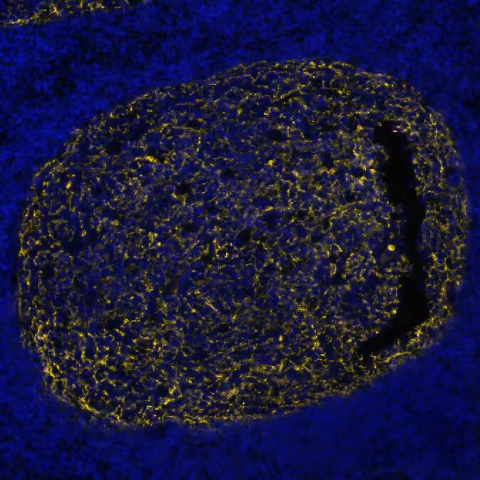 CD21 was detected in immersion fixed paraffin-embedded sections of human Lymph Node using Mouse Anti-Human CD21, Monoclonal Antibody (Catalog # NBP3-26866) at 1:800 at 37° Celsius for 4 minutes. Before incubation with the primary antibody, tissue underwent an all-in-one dewaxing and antigen retrieval preprocessing using PreTreatment Module (PT Module)and Dewax and HIER Buffer H (pH 9; Epredia Catalog #TA-999-DHBH). Tissue was stained using the Alexa Fluor™ 647 Goat anti-Mouse IgG Secondary Antibody at 1:200 at 37 ° Celsius for 2 minutes. (Yellow; Lunaphore Catalog # DR647MS) and counterstained with DAPI (blue; Lunaphore Catalog # DR100). Specific staining was localized to the membrane. Protocol available in COMET™ Panel Builder.