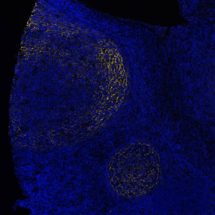 CD21 was detected in immersion fixed paraffin-embedded sections of human Tonsil using Mouse Anti-Human CD21, Monoclonal Antibody (Catalog # NBP3-26866) at 1:800 at 37° Celsius for 4 minutes. Before incubation with the primary antibody, tissue underwent an all-in-one dewaxing and antigen retrieval preprocessing using PreTreatment Module (PT Module)and Dewax and HIER Buffer H (pH 9; Epredia Catalog #TA-999-DHBH). Tissue was stained using the Alexa Fluor™ 647 Goat anti-Mouse IgG Secondary Antibody at 1:200 at 37 ° Celsius for 2 minutes. (Yellow; Lunaphore Catalog # DR647MS) and counterstained with DAPI (blue; Lunaphore Catalog # DR100). Specific staining was localized to the membrane. Protocol available in COMET™ Panel Builder.