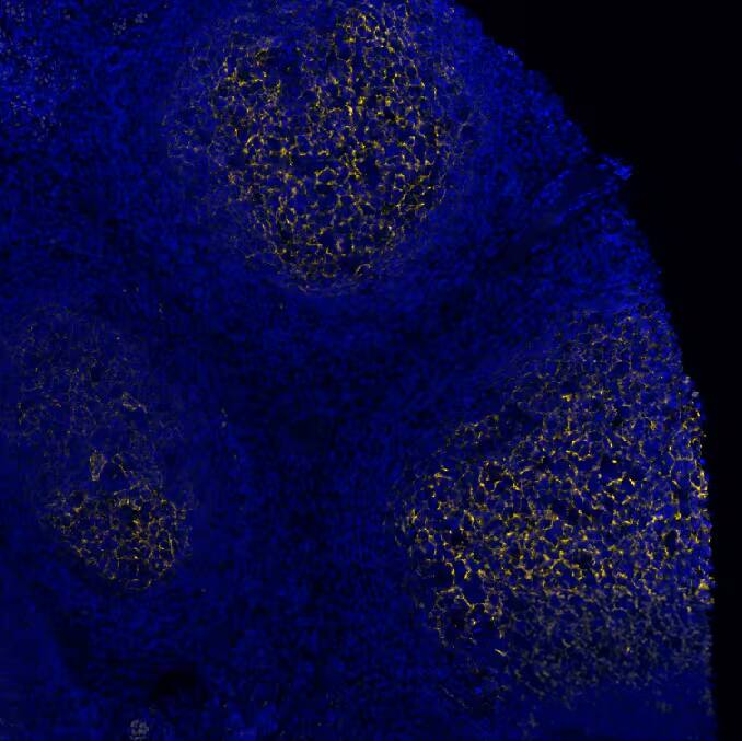 CD21 was detected in immersion fixed paraffin-embedded sections of human Tonsil using Rabbit Anti-Human CD21, Monoclonal Antibody (Catalog # NBP3-20354) at 1:2000 at 37° Celsius for 4 minutes. Before incubation with the primary antibody, tissue underwent an all-in-one dewaxing and antigen retrieval preprocessing using PreTreatment Module (PT Module) and Dewax and HIER Buffer H (pH 9; Epredia Catalog #TA-999-DHBH).Tissue was stained using the Alexa Fluor™ Plus 555 Goat anti-Rabbit IgG Secondary Antibody at 1:100 at 37 ° Celsius for 2 minutes. (Yellow; Lunaphore Catalog # DR555RB) and counterstained with DAPI (blue; Lunaphore Catalog # DR100). Specific staining was localized to the membrane. Protocol available in COMET™ Panel Builder. 