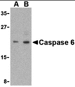 Western Blot: Caspase-6 Antibody [NBP3-27875] - Western blot analysis of Caspase-6 in MCF7 cell lysate with Caspase-6 antibody (IN) at (A) 1 and (B) 2 u/mL.