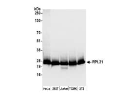  Whole cell lysate (50 µg) from HeLa, HEK293T,Jurkat, mouse TCMK-1, and mouse NIH 3T3 cells preparedusing NETN lysis buffer. Antibody: Affinity purified rabbitanti-RPL21 antibody used for WB at 0.1 µg/ml. Detection: Chemiluminescence withan exposure time of 1 second