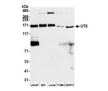 Whole cell lysate (50 µg) from LNCaP, HEK293T,Jurkat, TCMK-1, and NIH 3T3 cells prepared using NETNlysis buffer. Antibody: Affinity purified rabbit anti-UTXantibody used for WB at0.04 µg/ml. Detection: Chemiluminescence with anexposure time of 30 seconds.