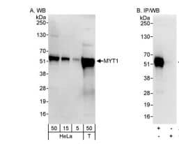 Western Blot: PKMYT1 Antibody-NBP3-30265-Whole cell lysate fromHeLa (5, 15 and 50 µg for WB; 1 mg for IP, 20% of IPloaded) and HEK293T (T; 50 ug) cells. Antibodies: Affinitypurified rabbit anti-MYT1 antibody used forWB at 0.04 ug/ml (A) and 1 ug/ml (B) and used for IP at 3µg/mg lysate. Detection: Chemiluminescence withexposure times of 30 seconds (A) and 10 seconds (B).