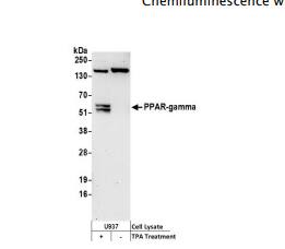 Whole cell lysate (50 µg) from U937 cellsincubated with (+) or without (-) TPA (200nM, 72 hrs) andlysed using NETN lysis buffer. Antibodies: Affinity purifiedrabbit anti-PPAR-gamma antibody used for WB at 0.1 µg/ml. Detection:Chemiluminescence with an exposure time of 75 seconds.