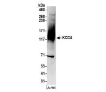 Whole cell lysate (50 µg) prepared using NETN buffer fromJurkat cells. Antibodies: Affinity purified rabbit anti-KCC4antibody used for WB at 0.4µg/ml. Detection: Chemiluminescence with an exposuretime of 3 minutes