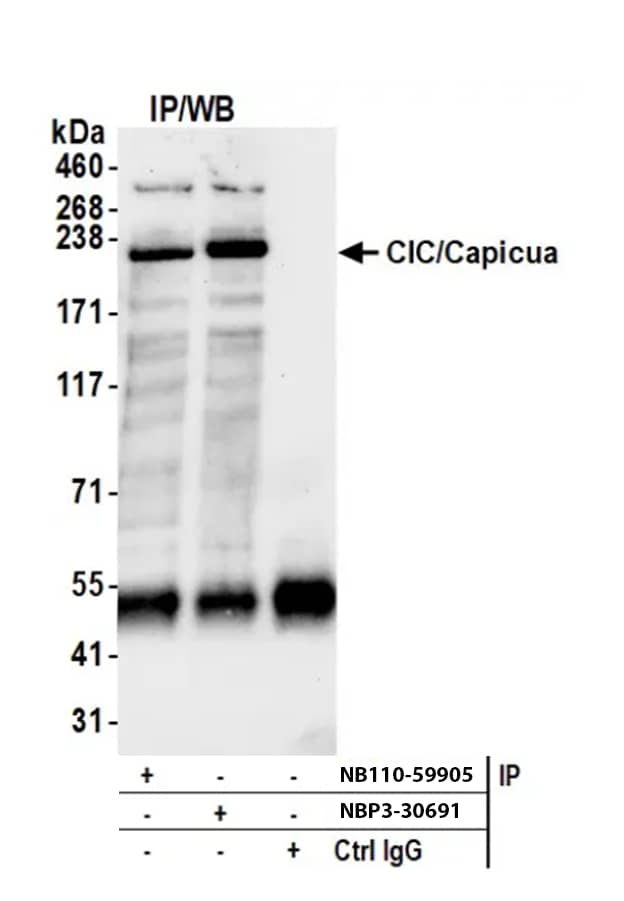 Immunoprecipitation: Rabbit Capicua pAb [NBP3-30691] - Samples: Whole cell lysate (1 mg per IP; 20% of IP loaded) from HeLa cells prepared using NETN lysis buffer. Antibodies: Affinity purified rabbit anti-CIC/Capicua antibody (NBP3-30691) used for IP at 6 µg per reaction. CIC/Capicua was also immunoprecipitated by a second antibody against a different epitope of CIC/Capicua (NB110-59905). For blotting immunoprecipitated CIC/Capicua, A301-204A was used at 1 µg/ml. Detection: Chemiluminescence with an exposure time of 30 seconds.