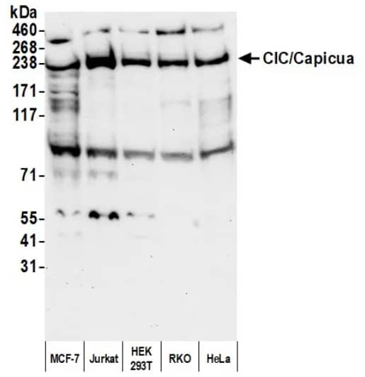 Western Blot: Rabbit Capicua pAb [NBP3-30691] - Samples: Whole cell lysate (50 µg) from MCF-7, Jurkat, HEK293T, RKO, and HeLa cells prepared using NETN lysis buffer. Antibody: Affinity purified rabbit anti-CIC/Capicua antibody (NBP3-30691) used for WB at 0.4 µg/ml. Detection: Chemiluminescence with an exposure time of 75 seconds.