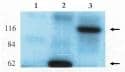 Western Blot: Sheep GEF-H1 pAb [NBP3-30801] - Analysis using anti-GEF-H1 antibody on HEK-293 cell transfected with vector alone (1), GEF-H1-short (2) and GEF-H1-long (3).