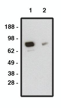 Western Blot: Rabbit Smoothened pAb [NBP3-30939] - Analysis using Smoothened pAb on human brain lysate. Lysate loaded at 15µg/lane. Antibody used at 10 µg/ml (1) and 5 µg/ml (2) dilution. Secondary antibody, mouse anti-rabbit-HRP, used at 1:150K dilution.