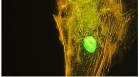 Immunofluorescence:SOX2 Antibody[NBP3-31961]- staining of NTERA2 cells stained with Novus Biologicals anti-SOX2 antibody (green) showing strong nuclear staining of endogenous SOX2. Actin filaments are stained with phalloidin (red).