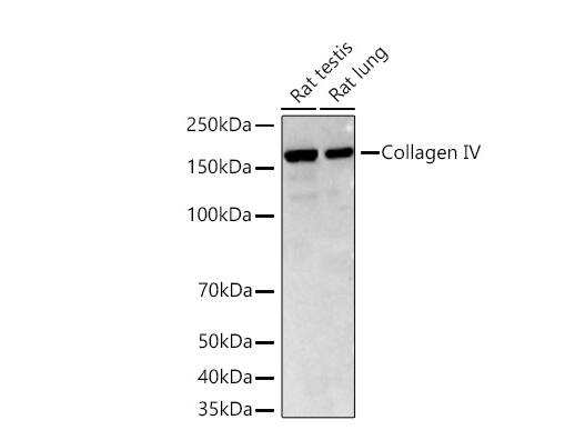 Analysis of various lysates using Collagen IV Rabbit mAb at 1:7000 dilution incubated at room temperature for 1.5 hours.Secondary antibody: HRP-conjugated Goat anti-Rabbit IgG (H+L) at 1:10000 dilution.Lysates/proteins: 25 μg per lane.Blocking buffer: 3% nonfat dry milk in TBST.Detection: ECL Basic Kit. Exposure time: 45 s.