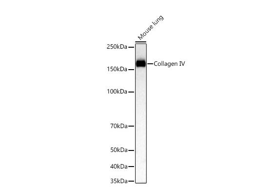 Analysis of lysates from Mouse lung using Collagen IV Rabbit mAb at 1:7000 dilution incubated at room temperature for 1.5 hours.Secondary antibody: HRP-conjugated Goat anti-Rabbit IgG (H+L) at 1:10000 dilution.Lysates/proteins: 25 μg per lane.Blocking buffer: 3% nonfat dry milk in TBST.Detection: ECL Basic Kit. Exposure time: 45 s.