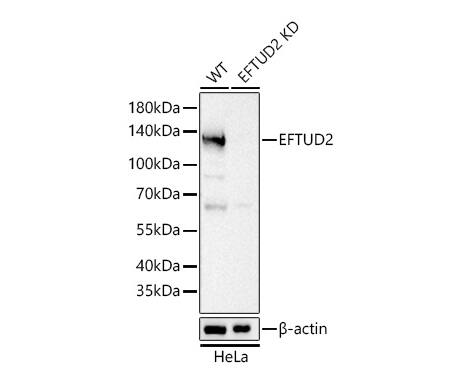 Analysis of lysates from wild type (WT) and EFTUD2 knockdown (KD) HeLa cells using [KD Validated] EFTUD2 Rabbit mAb (at 1:5000 dilution incubated at room temperature for 1.5 hours.Secondary antibody: HRP-conjugated Goat anti-Rabbit IgG (H+L) at 1:10000 dilution.Lysates/proteins: 25 μg per lane.Blocking buffer: 3% nonfat dry milk in TBST.Detection: ECL Basic Kit. Exposure time: 1s.