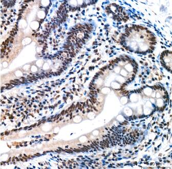 Immunohistochemistry-Paraffin:REPIN1 Antibody (2X2E9)-Human colon tissue using REPIN1 Rabbit mAb at a dilution of 1:200 (40x lens). High pressure antigen retrieval performed with 0.01M Citrate Buffer (pH 6.0) prior to IHC staining.
