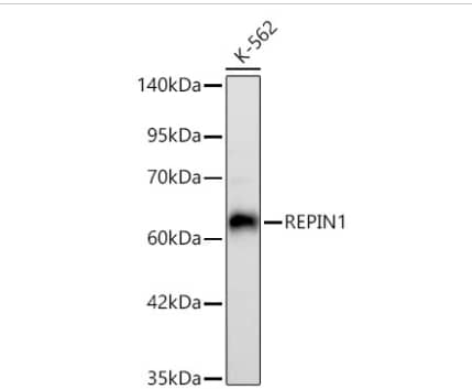 Western Blot:REPIN1 Antibody (2X2E9)-Analysis of lysates from K-562 cells using REPIN1 Rabbit mAb  at 1:40000 dilution incubated overnight at 4℃.Secondary antibody: HRP-conjugated Goat anti-Rabbit IgG (H+L) at 1:10000 dilution.Lysates/proteins: 25 μg per lane.Blocking buffer: 3% nonfat dry milk in TBST.Detection: ECL Basic Kit. Exposure time: 45s.