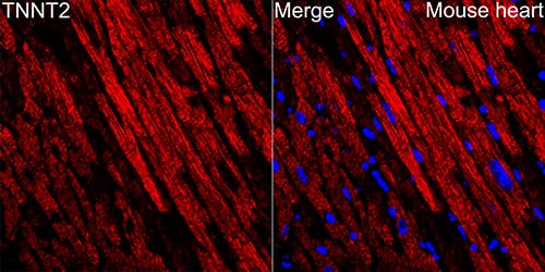 Immunohistochemistry: Rabbit Cardiac Troponin T mAb (10H9D8) [NBP3-33537] - Immunofluorescence analysis of paraffin-embedded mouse heart using Cardiac troponin T (TNNT2) Rabbit mAb (A4914) at dilution of 1:100 (40x lens). Secondary antibody: Cy3-conjugated Goat anti-Rabbit IgG (H+L) (AS007) at 1:500 dilution. Blue: DAPI for nuclear staining.