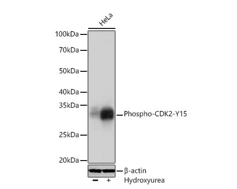 Analysis of lysates from HeLa cells using Phospho-CDK2-Y15 Rabbit mAb at 1:1000 dilution incubated overnight at 4℃. HeLa cells were treated with Hydroxyurea (4 Mm) at 37℃ for 20 hours at 37℃ for 24 hours.Secondary antibody: HRP-conjugated Goat anti-Rabbit IgG (H+L)at 1:10000 dilution.Lysates/proteins: 25 μg per lane.Blocking buffer: 3 % nonfat dry milk in TBST.Detection: ECL Basic Kit. 