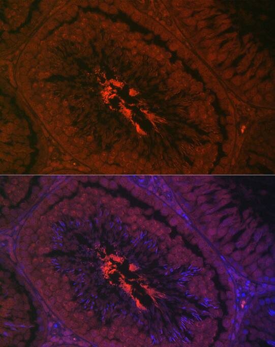 Human testis using AKAP4 Rabbit pAb at dilution of 1:200 (40x lens). Secondary antibody: Cy3-conjugated Goat anti-Rabbit IgG (H+L) at 1:500 dilution. Blue: DAPI for nuclear staining. Perform high pressure antigen retrieval with 0.01 M citrate buffer (pH 6.0) prior to IF staining.