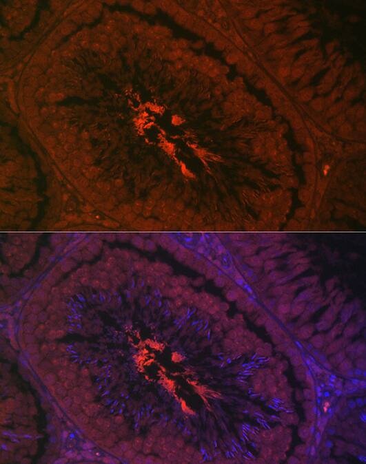 Paraffin-embedded rat testis using AKAP4 Rabbit pAb at dilution of 1:200 (40x lens). Secondary antibody: Cy3-conjugated Goat anti-Rabbit IgG (H+L) at 1:500 dilution. Blue: DAPI for nuclear staining. Perform high pressure antigen retrieval with 0.01 M citrate buffer (pH 6.0) prior to IF staining.