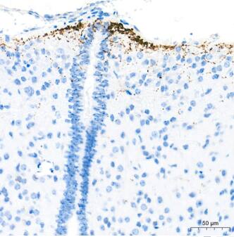  Analysis of paraffin-embedded Mouse hypothalamus tissue using GNRH1 Rabbit pAb at a dilution of 1:1000 (40x lens). High pressure antigen retrieval performed with 0.01M Tris-EDTA Buffer (pH 9.0) prior to IHC staining.