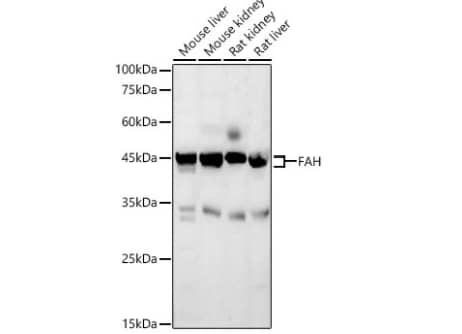 Western Blot: Fumarylacetoacetate hydrolase Antibody [NBP3-38291] -