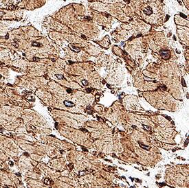 Beta Sarcoglycan was detected in immersion fixed paraffin-embedded sections of human heart tissue using 0.5 µg/mL Rabbit Anti-Human beta Sarcoglycan Affinity-purified Polyclonal Antibody (Catalog # NBP3-38648) overnight at 4 °C. Before incubation with the primary antibody tissue was subjected to heat-induced epitope retrieval using Antigen Retrieval Reagent-Basic (Catalog # CTS013). Tissue was stained with the Anti-Rabbit HRP-DAB Cell & Tissue Staining Kit (brown) and counterstained with hematoxylin (blue). View our protocol for Chromogenic IHC Staining of Paraffin-embedded Tissue Sections. 