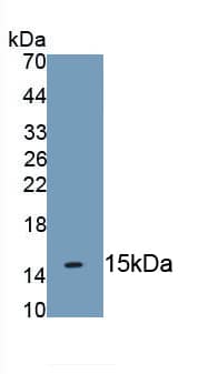 Western Blot: Cytokeratin 2 Antibody (D8) [NBP3-41134] - Recombinant Human Cytokeratin 2 