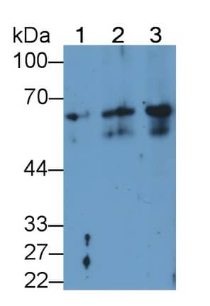 Western Blot: Cytokeratin 2 Antibody (D8) [NBP3-41134] - Sample: Lane1: Rat Liver lysate; Lane2: A431 cell lysate; Lane3: HepG2 cell lysate; Primary Ab: 2ug/ml NBP3-41134; Second Ab: 0.2ug/mL HRP-conjugated Goat Anti-Mouse IgG Polyclonal Antibody