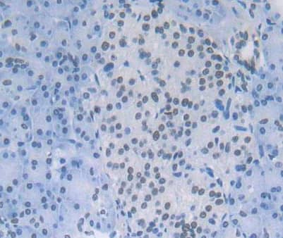 Immunohistochemistry-Paraffin:Kallikrein 12 Antibody-Kallikrein 12 Antibody-
