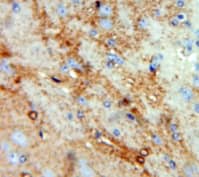 Immunohistochemistry-Paraffin CCL4L2 Antibody