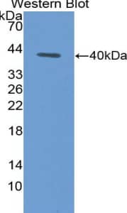 Western Blot CCL4L2 Antibody