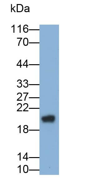 Western Blot: GGT1 Antibody (13#) [NBP3-41493] - Recombinant Human GGT1