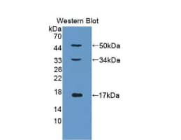 Western Blot:Collagen X alpha 1 Antibody (D1)-