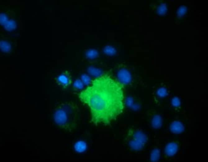 Anti-PEX5 mouse monoclonal antibody immunofluorescent staining of COS7 cells transiently transfected by pCMV6-ENTRY PEX5