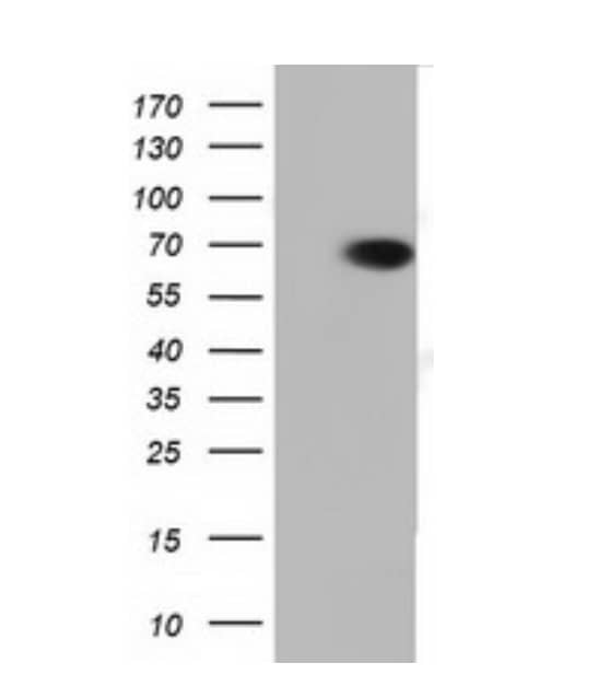 HEK293T cells were transfected with the pCMV6-ENTRY control (Left lane) or pCMV6-ENTRY PEX5 (RC202062, Right lane) cDNA for 48 hrs and lysed. Equivalent amounts of cell lysates (5 ug per lane) were separated by SDS-PAGE and immunoblotted with anti-PEX5. 