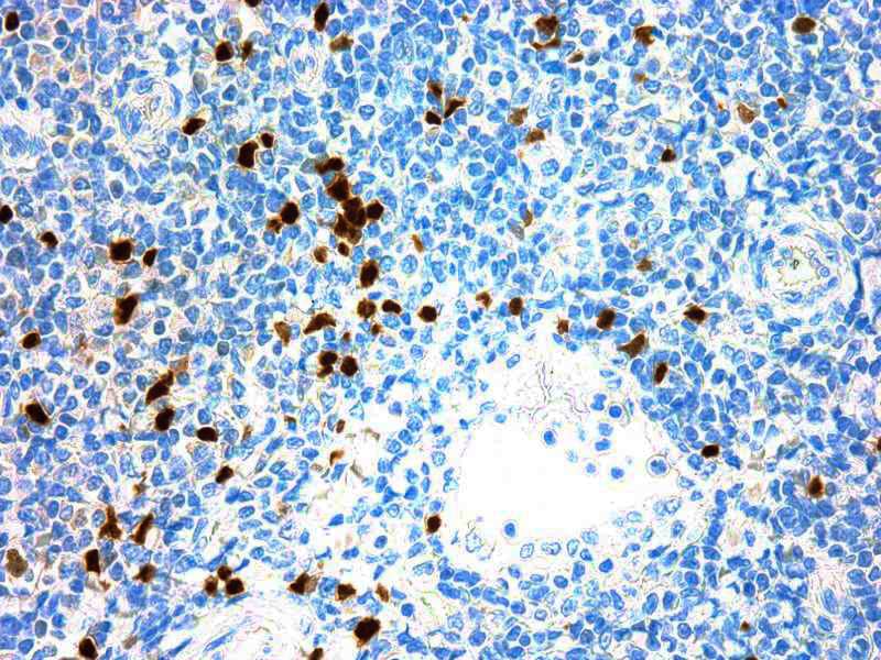 Formalin fixed paraffin embedded human tonsil stained with Tdt antibody.