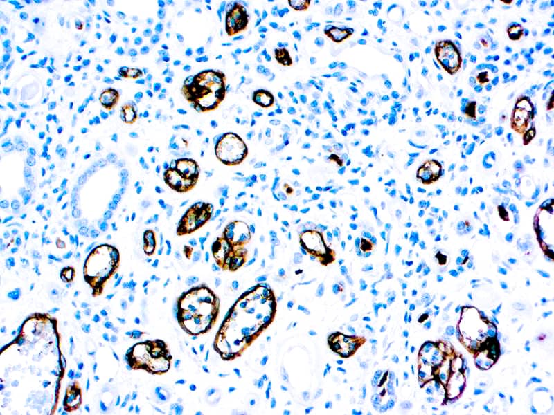 Formalin fixed paraffin embedded human rejected kidney stained with C4D.