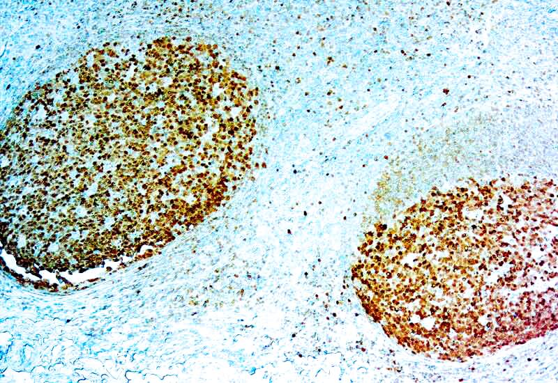 Formalin fixed paraffin embedded human Tonsil stained with BOB1.
